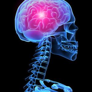Tumor Headache - Cluster Migraine Headaches Causes