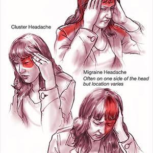 Migraine Trigger Avoidance - Are The Causes Of Migraines Genetic In Nature