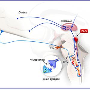 Migraine Arteries - Does The Weather Affect Migraine Headaches?