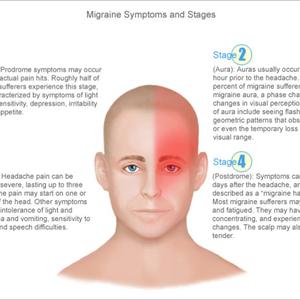 Migraine Seizure Connection - 3 Natural Cures For A Migraine